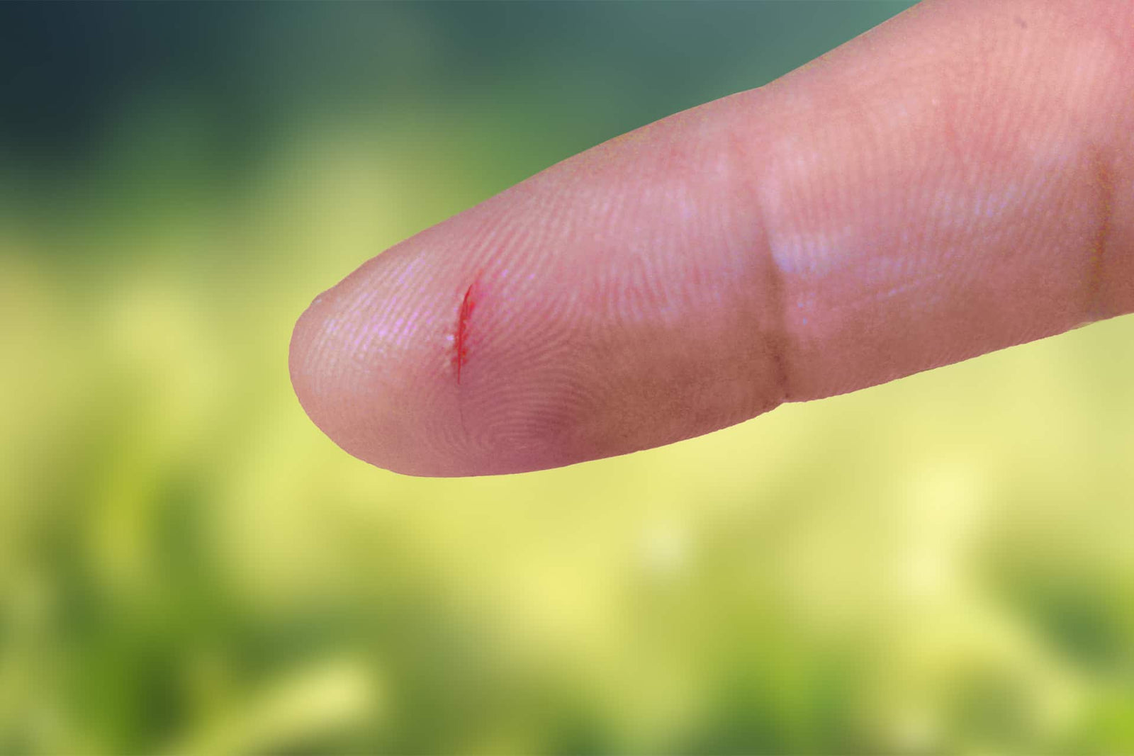 STOP Using Super Glue on Your Cuts and Cracked Skin! - Cloud 9