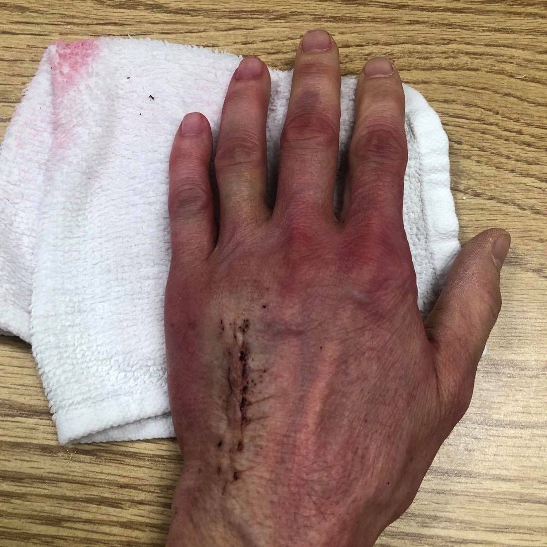 Uncovering the Hidden Dangers of Cortisone Creams