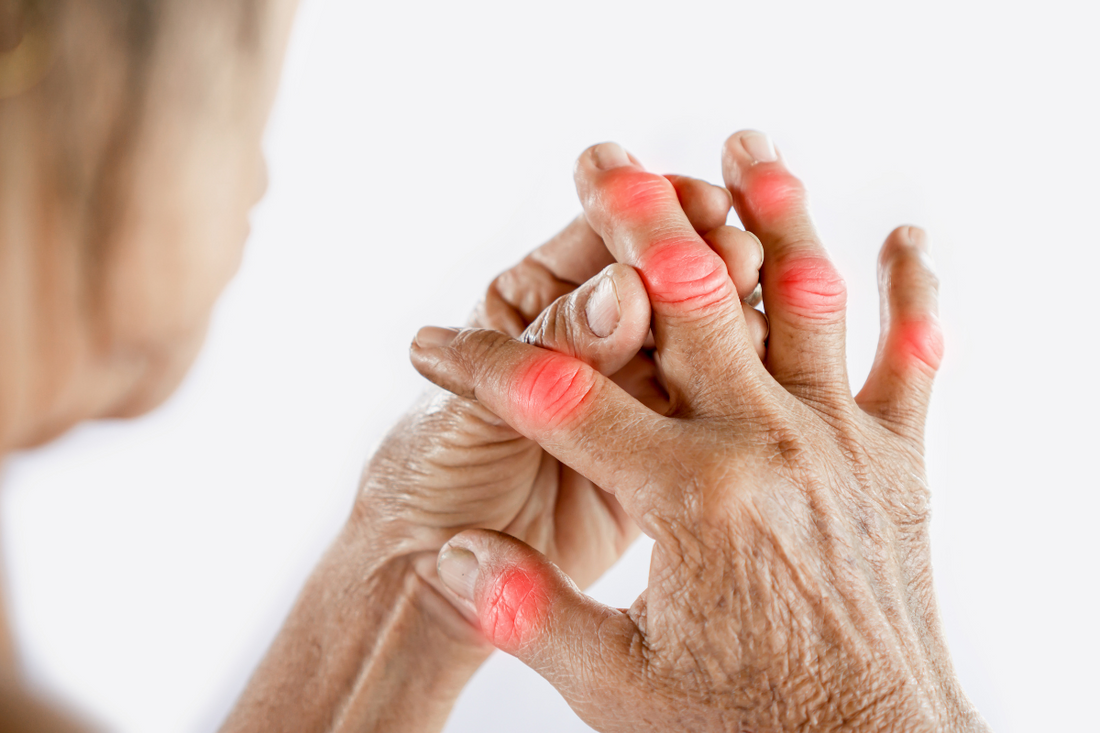 Unlocking Natural Pain Relief: How Essential Oils and MSM Can Alleviate Arthritis Symptoms