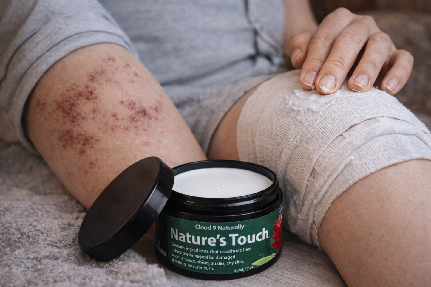 Nature’s Touch: Skin repair