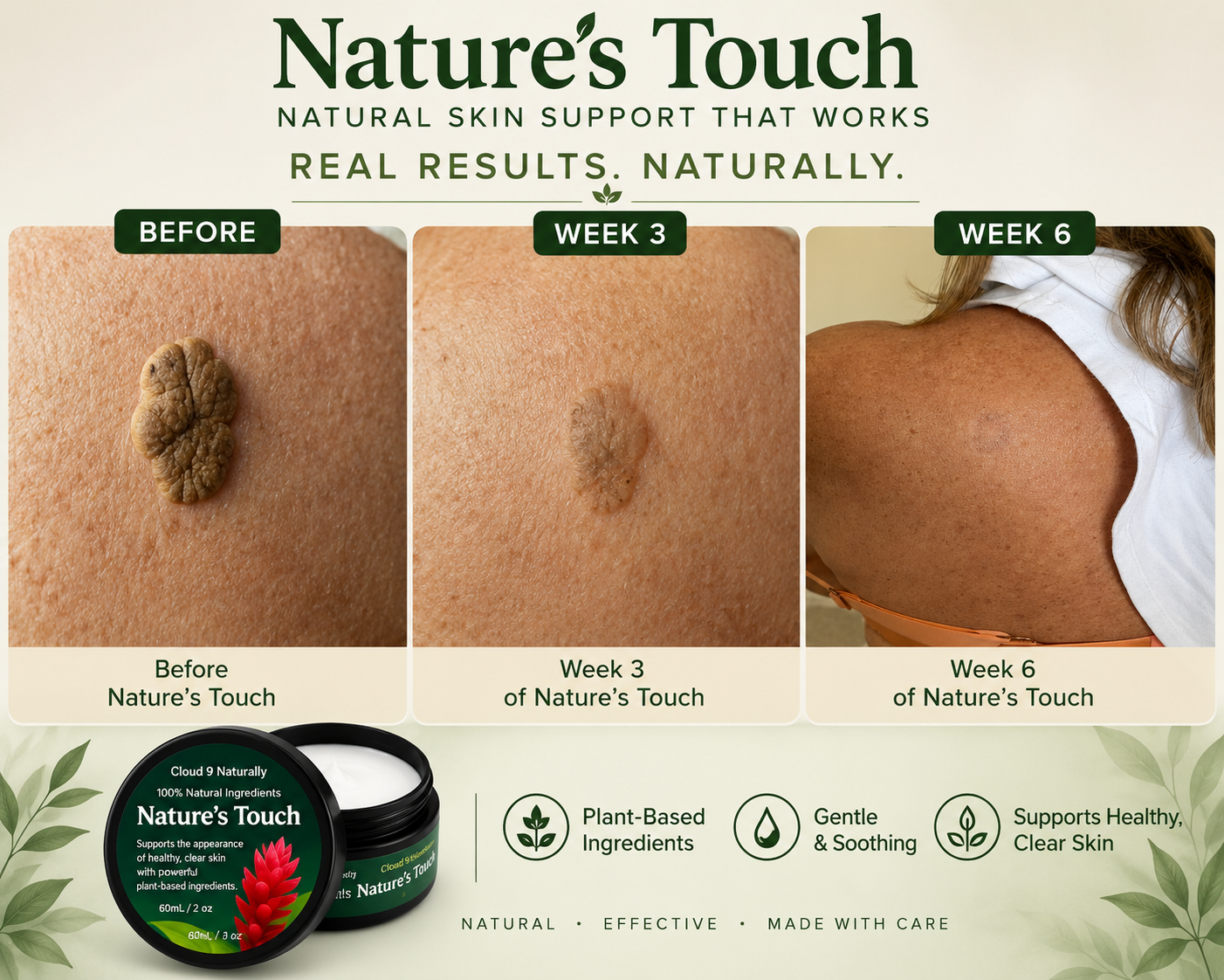 Nature’s Touch: Skin repair