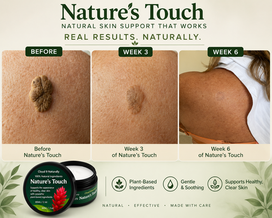 Nature’s Touch: Skin repair