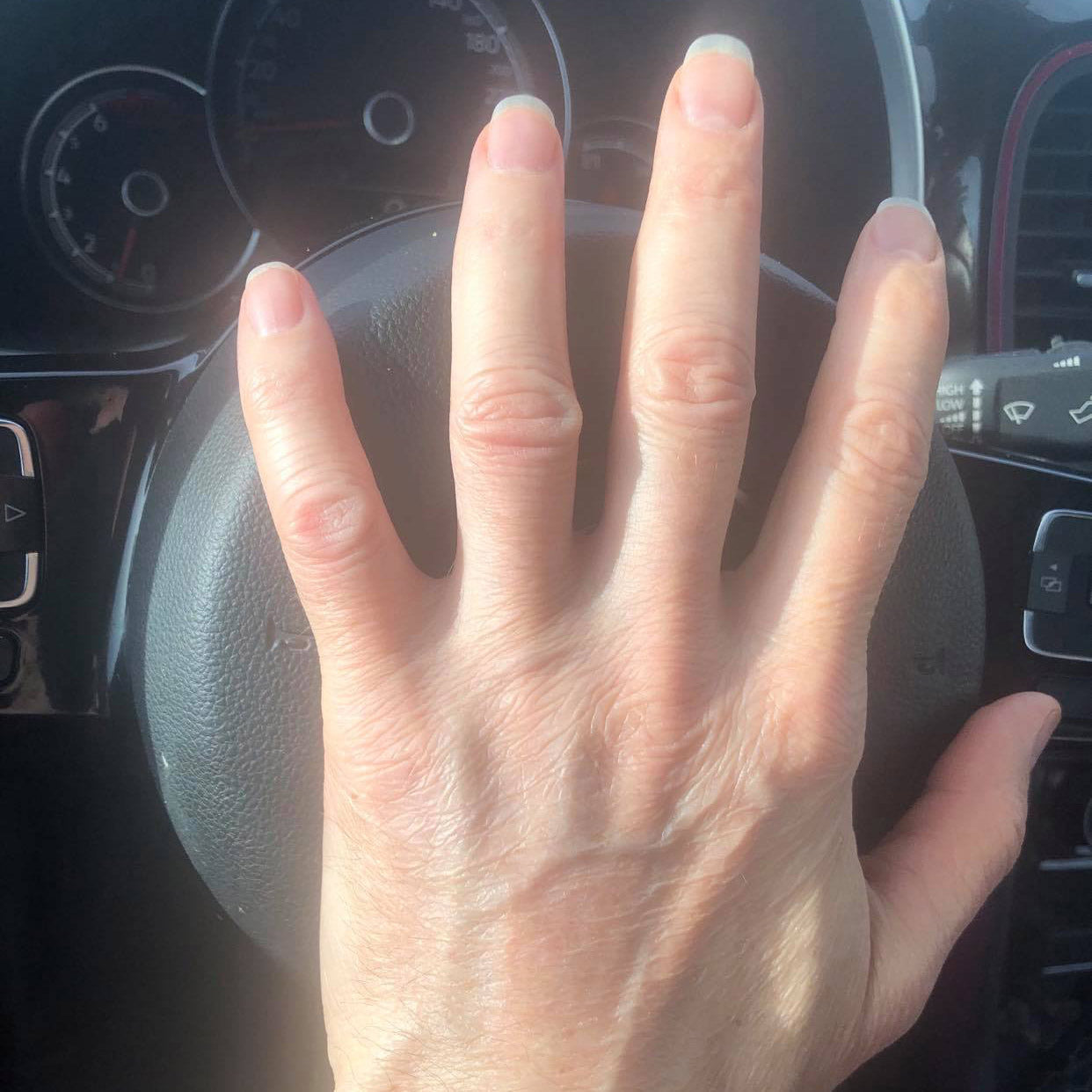 Nature’s Touch: Skin repair