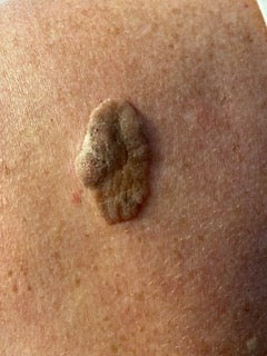 Nature’s Touch: Skin repair