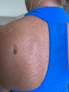 Nature’s Touch: Skin repair